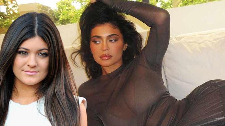 Kylie Jenner estetik savlarını yalanladı: Sırf dolgu yaptırdım
