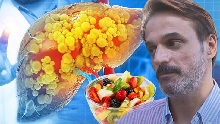Ufuk Özkan'ın karaciğerini bitiren meyve diyeti mi? Menajeri de açıkladı, gerçek çok öteki