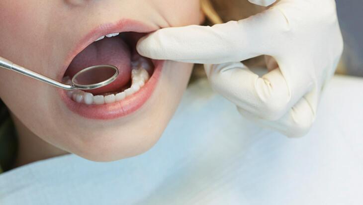 Çocuklar diş doktorundan korkuyor! 'Korku ve tasa seviyeleri yüksek olabiliyor'